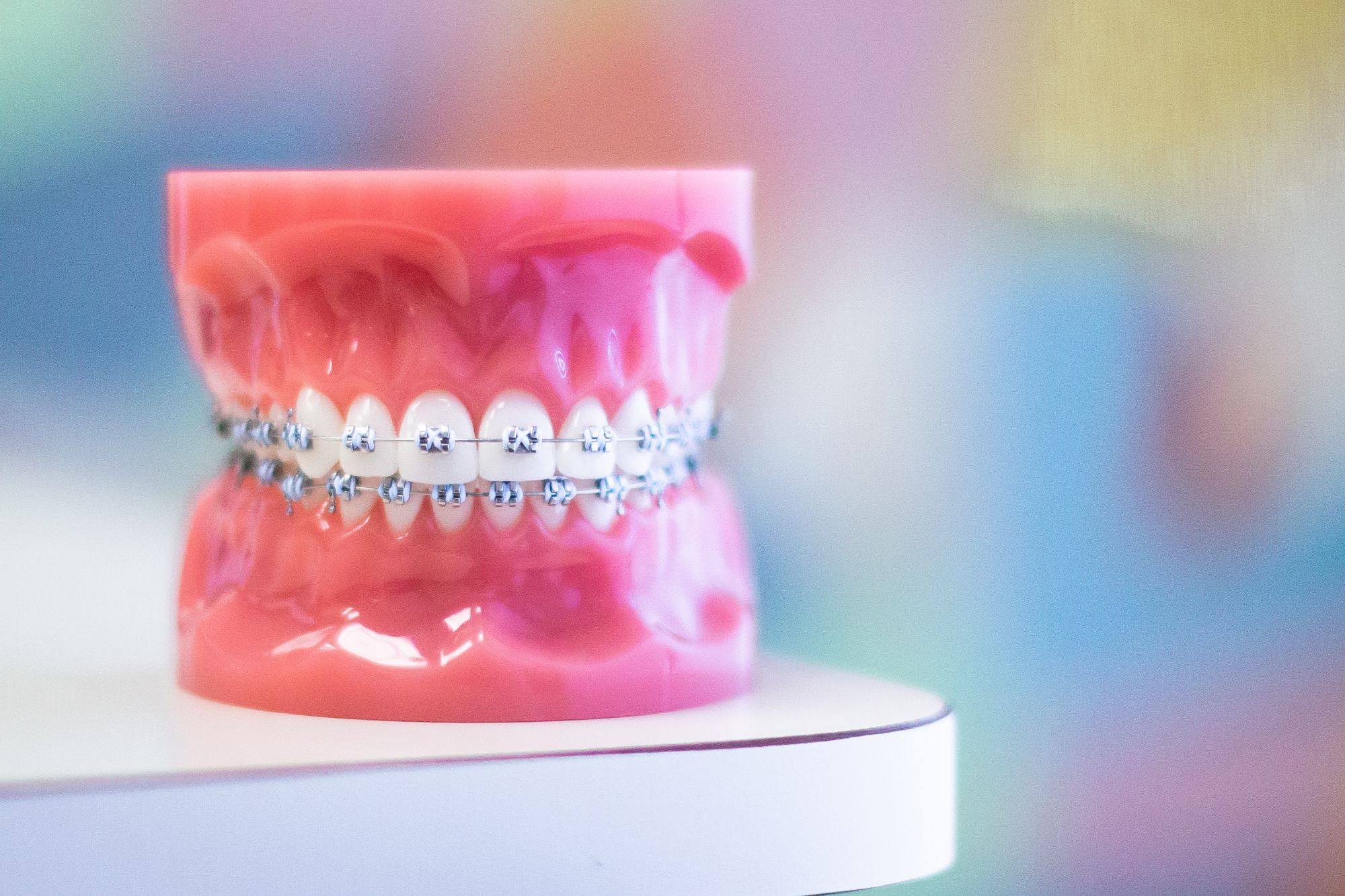 Metal Braces - Petrunic Orthodontics Braces Prattville