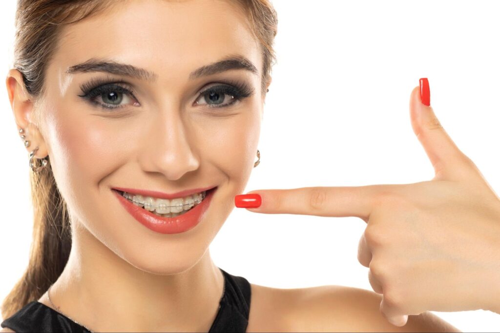 What Are Some Benefits of Orthodontic Treatment for Adults?
