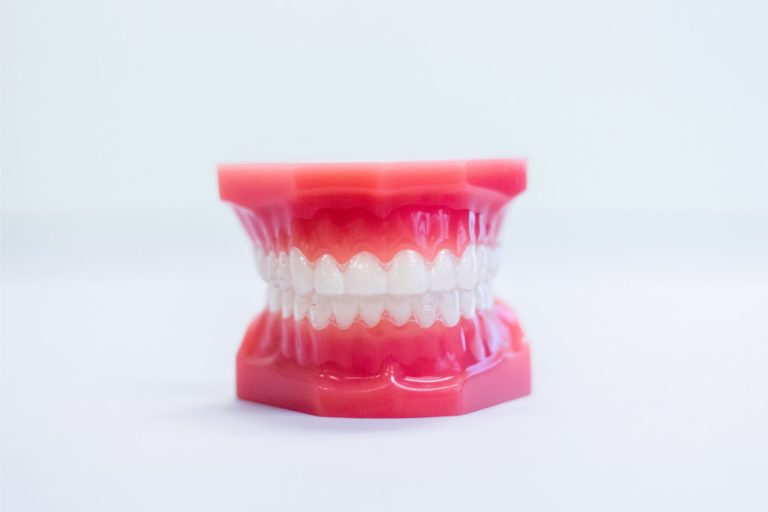 metal braces prattville al